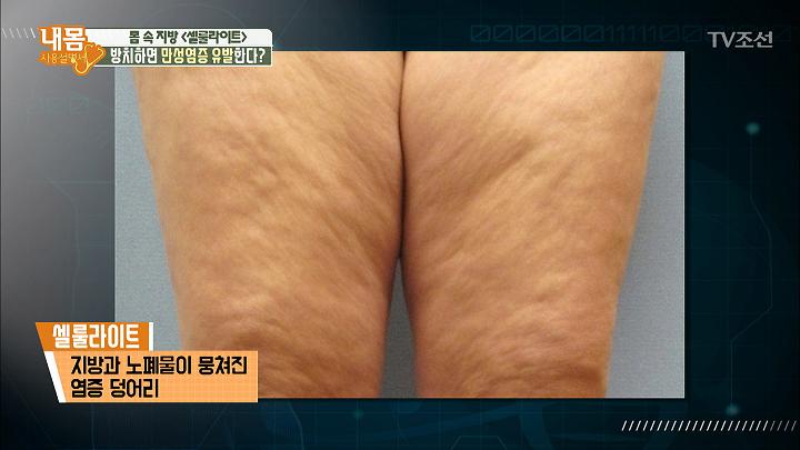 인기클립 TOP20
