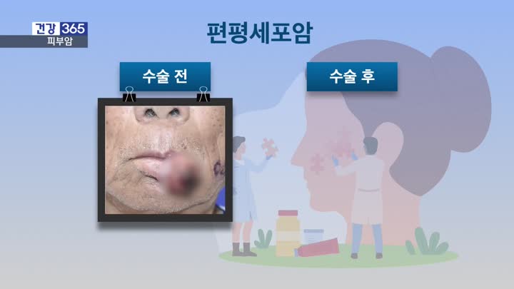 PR 이미지