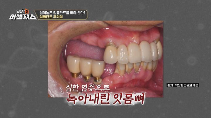 인기클립 TOP20
