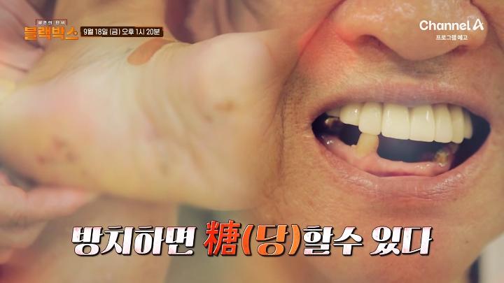 인기클립 TOP20