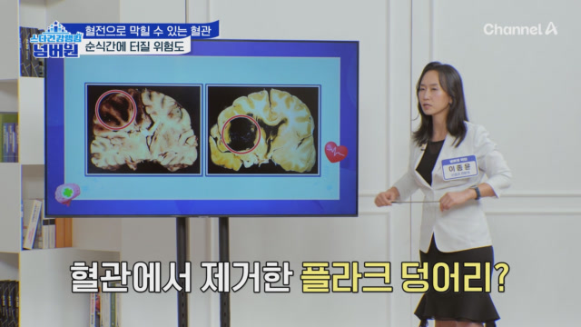 PR 이미지
